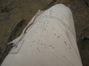 img_0155 The other leg looks the same (as my hair probably did), and yes those are all little web-bound bugs.